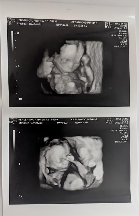 Prank 3D Customized Fake Ultrasound Strip of 2 Photos